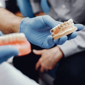 Plastic jaw in the dentist's office. The doctor holds in the hands of dental implants.